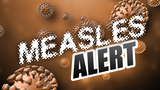 Measles case reported in central California