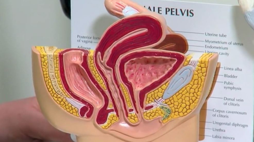 Here's what you need to about Pelvic Floor Dysfunction WKRC