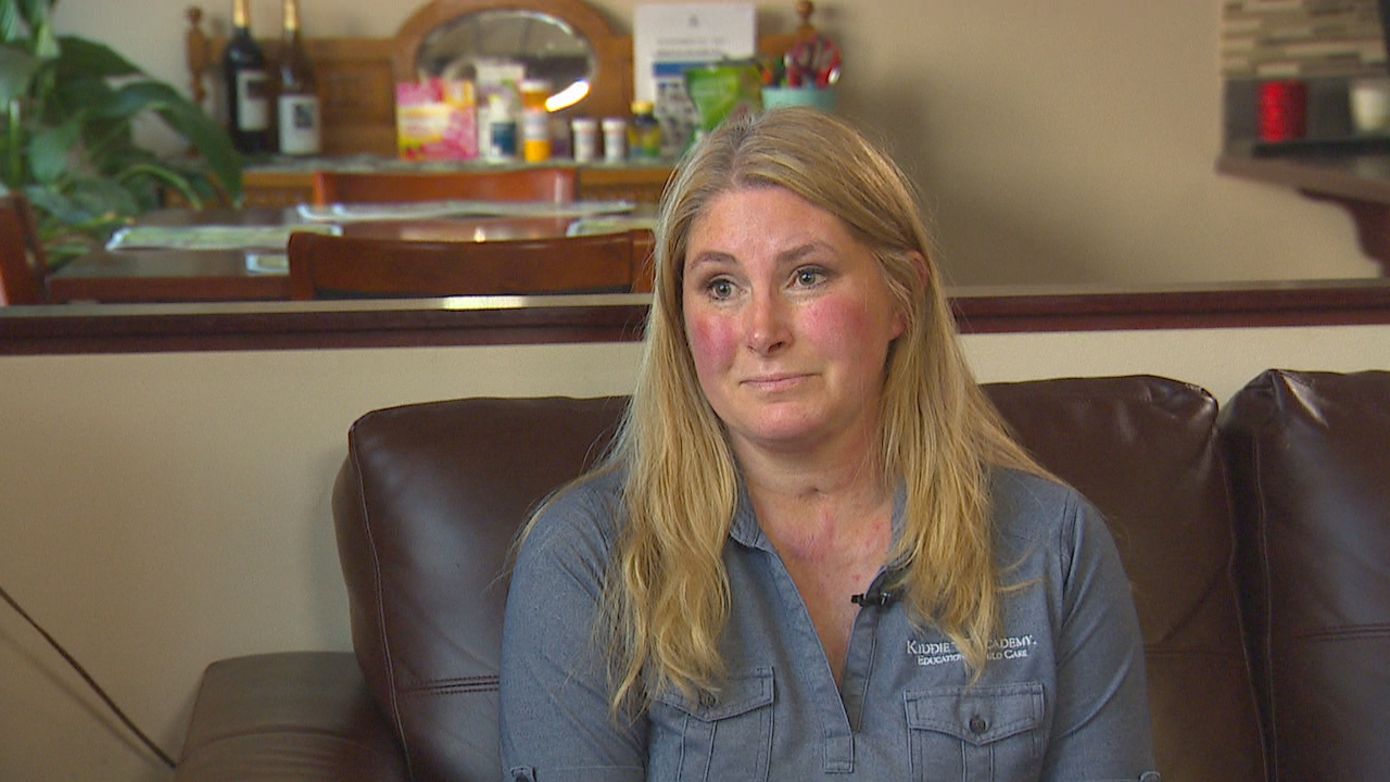 Woman reclaims life 3 years after being set on fire, left for dead by exhusband