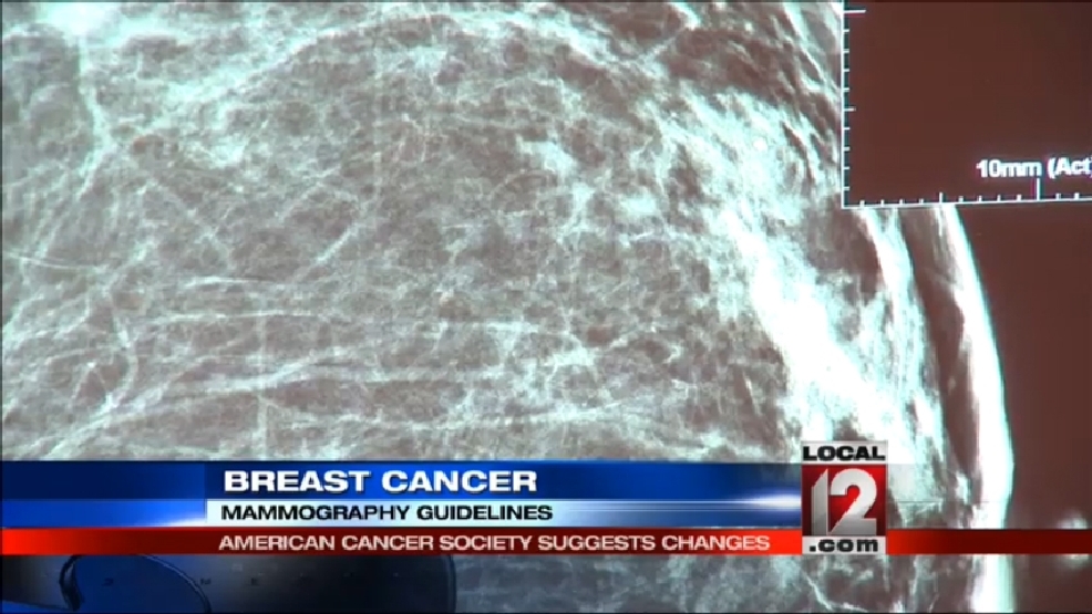 New ACS mammogram guidelines WKRC